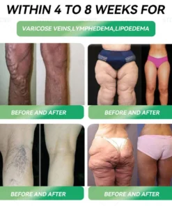 𝐓𝐒𝐄𝐋𝐃® 𝐆𝐋𝐏-𝟏 𝐒𝗹𝐢𝐦𝐦𝐢𝐧𝐠 & 𝐇𝐞𝐚𝗹𝐭𝐡 𝐈𝐦𝐩𝐫𝐨𝐯𝐞𝐦𝐞𝐧𝐭 𝐀𝐦𝐩𝐨𝐮𝗹𝐞 𝐃𝐫𝐨𝐩𝐬