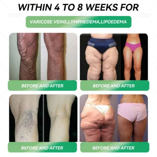 𝐓𝐒𝐄𝐋𝐃® 𝐆𝐋𝐏-𝟏 𝐒𝗹𝐢𝐦𝐦𝐢𝐧𝐠 & 𝐇𝐞𝐚𝗹𝐭𝐡 𝐈𝐦𝐩𝐫𝐨𝐯𝐞𝐦𝐞𝐧𝐭 𝐀𝐦𝐩𝐨𝐮𝗹𝐞 𝐃𝐫𝐨𝐩𝐬